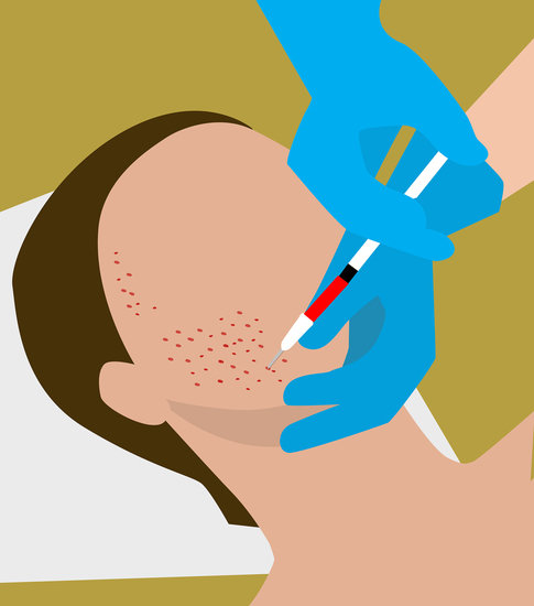 Beauty rituals vampire facial 485 xxx q85